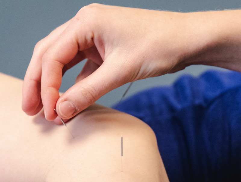 akupunktur nålebehandling
